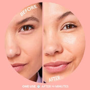 Serve Chilled Bubbly Brightening Hydrogel Mask | Patchology