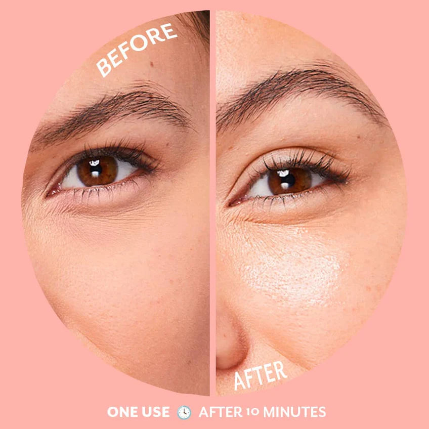 Serve Chilled Bubbly Eye Gels | Patchology